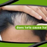 Does Keto Cause Hair Loss?